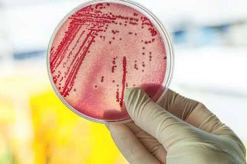 New way to test for drug resistant infections