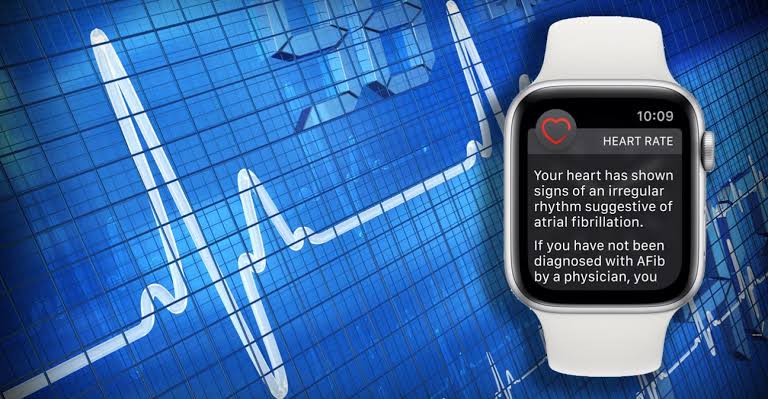 Apple Watch detects irregular heartbeats : Finds US study