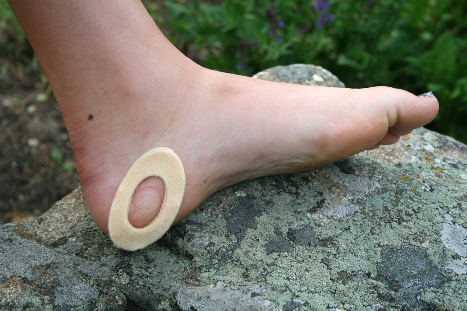 how to cure blisters on feet