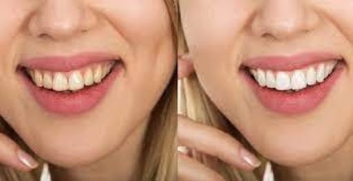 How to whiten teeth in photoshop