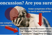 How to get rid of Head Pressure from Concussion