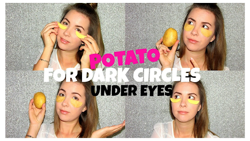 Raw Potatoes for dark circles